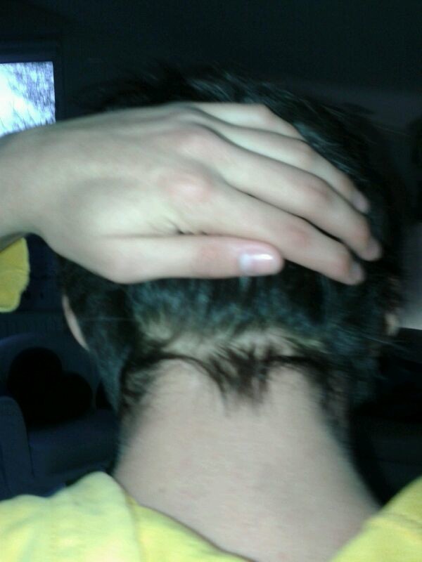 Haaruitval gestopt, eigen haarkleur terug, inhammen verdwenen